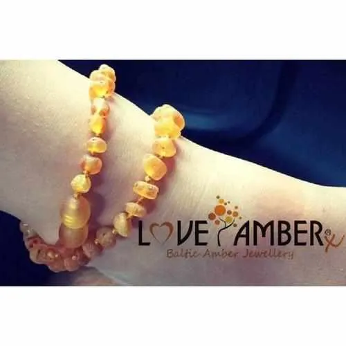 Child Bees Knees Raw Honey Baltic Amber Anklet Bracelet
