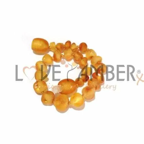 Child Bees Knees Raw Honey Baltic Amber Anklet Bracelet